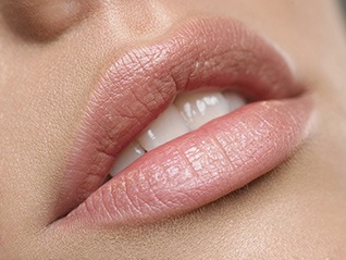 Lip Enhancement