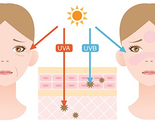 Sun Damaged Skin