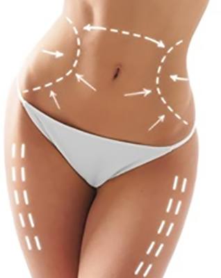 Body Contouring | Ultrashape